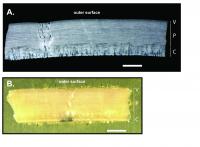 Thin-section photomicrograph of ostrich eggshells