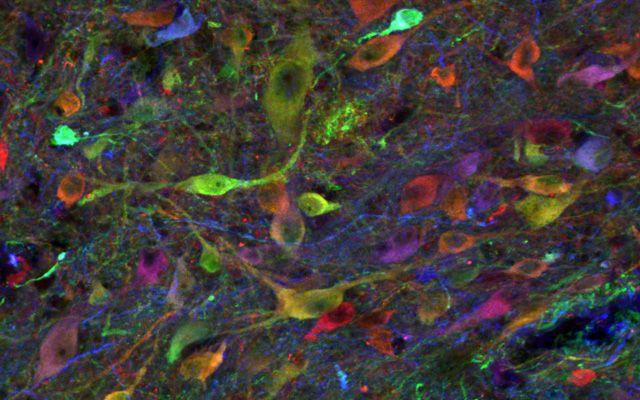 IPSCs Derived Neurons