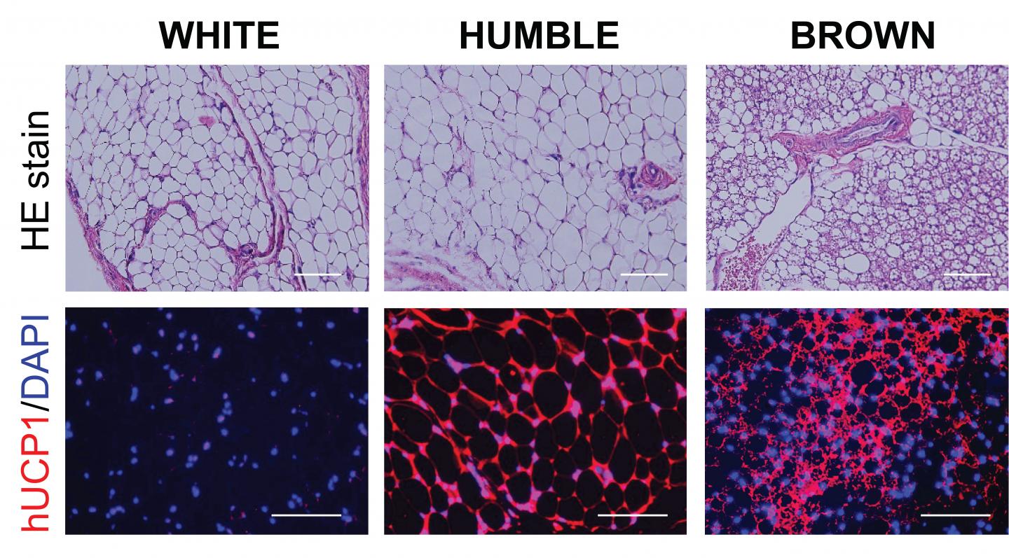 Electron microscopic images of white, HUMBLE and brown fat