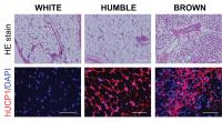 Electron microscopic images of white, HUMBLE and brown fat