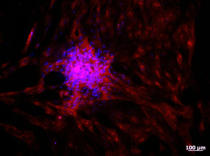 Cells Injected into Retina