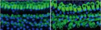 Cochlea After Damage Only and After Damage and Replacement of Hair Cells