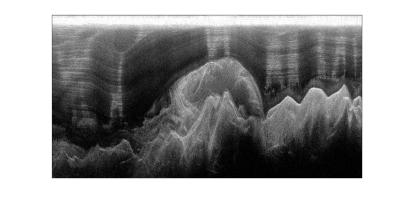 Bottoms Up -- Surprising Structure of Antarctic Ice Sheets (5 of 6)