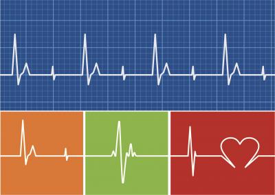 Heart Rhythm