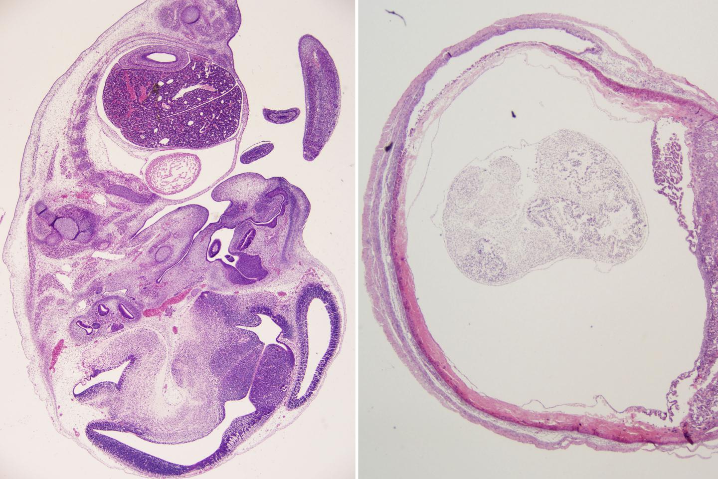 Fetuses Treated with Zika Antibody