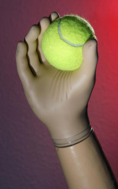 Prosthesis