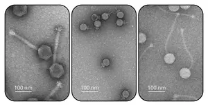 Electron micrographs of bacterial viruses