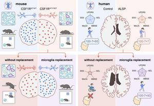 Microglia replacement effectively halts the progression of ALSP in mice and human individuals