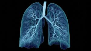 Lung digital twin with aerosol particles ©Ebenbuild 2026
