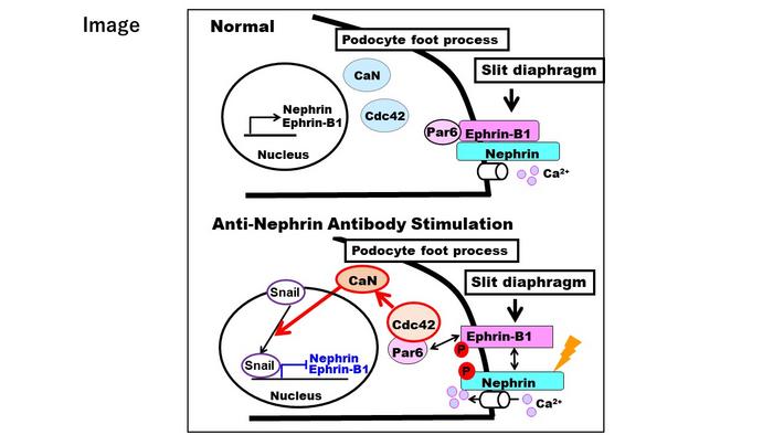 Pathogenic mechanisms of nephrotic syndrome caused by anti-nephrin antibody.