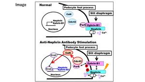 Pathogenic mechanisms of nephrotic syndrome caused by anti-nephrin antibody.