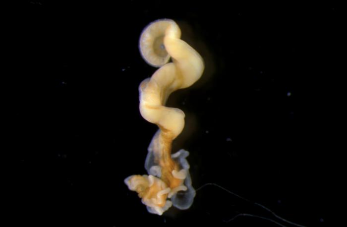 Nematostella up close