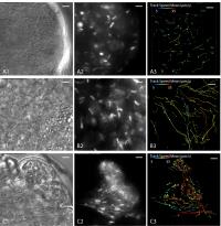 Trypanosomes Swimming in Clusters
