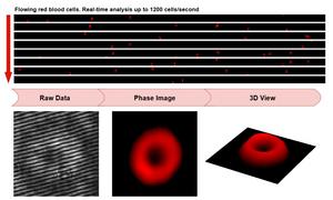 Flowing red blood cells (RBCs) are imaged under the high-throughput QPM.