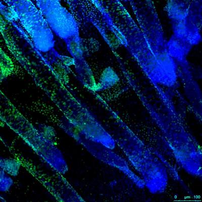 Skin Stem Cells