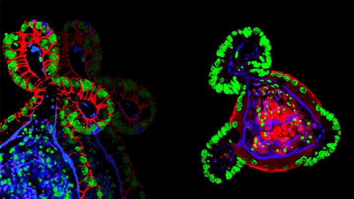 Intestinal Organoids in Synthetic Hydrogels
