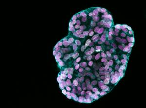 Single paediatric gastric organoids
