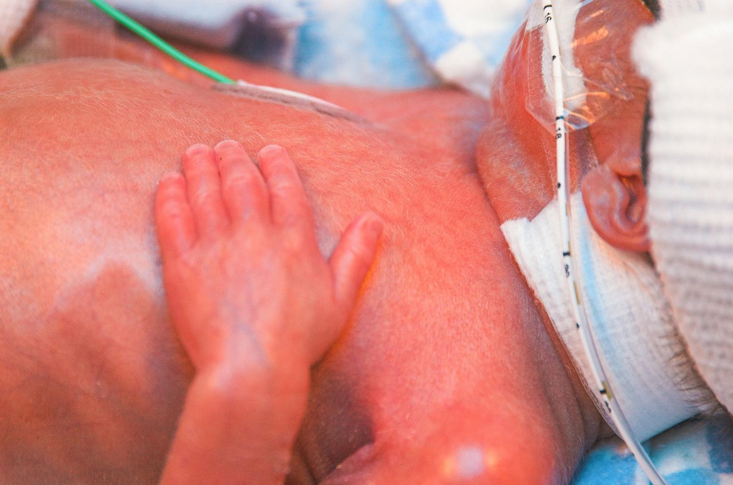 Premature Baby Resting