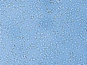 Pandoraea bacteria