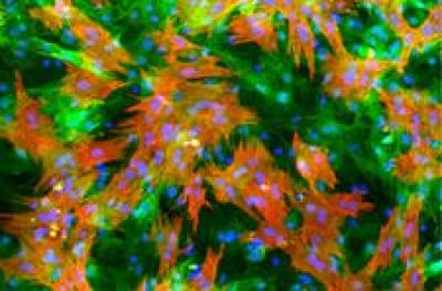 Heart Cells