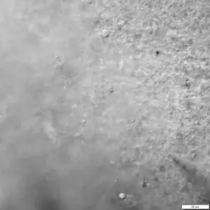 A micropipette from the multipatch device approaches an individual neuron