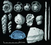 Microscopic Food Remains