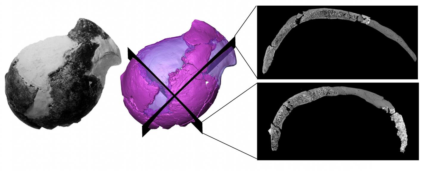 Jacovec Cranium