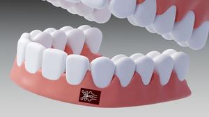 Detecting gum disease