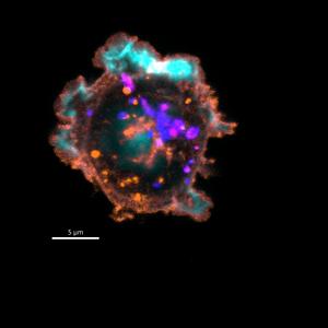 Natural killer cell