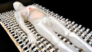 Alternating pressure mattress