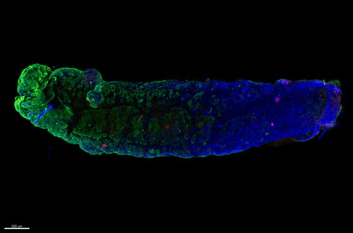 Gastric multi-regional assembloid