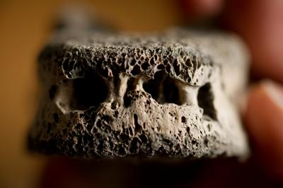 Vertebra