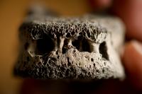 Vertebra