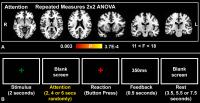 Figure 2: Psychomotor Vigilance