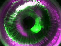 Intact Human Eye