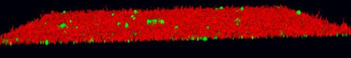 Bacterial Biofilm In The Presence Of Inhibitory Compounds.
