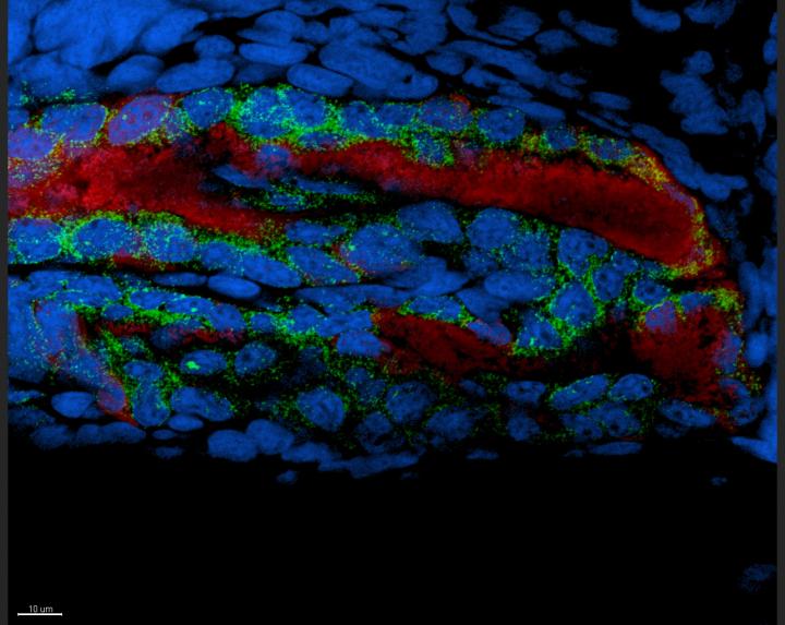 Luminous Symbionts (Red) Induce Edema-Associated Gene Expression (Green) in Adjacent Host Epithelia 