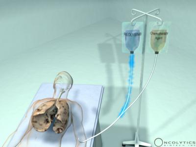 Combination of Chemo and Reolysin