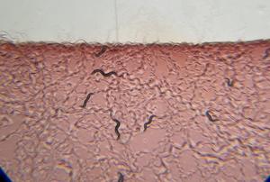 Worms in Serratia marcescens