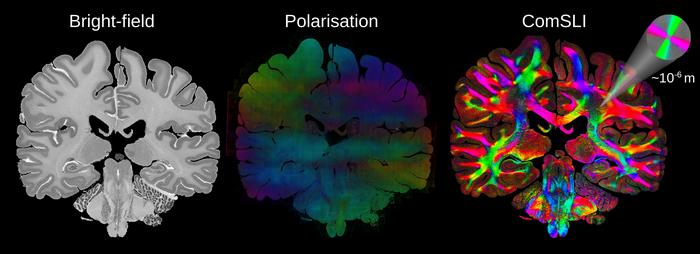 Human brain FFPE section from the BigBrain atlas measured with different techniques