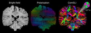 Human brain FFPE section from the BigBrain atlas measured with different techniques