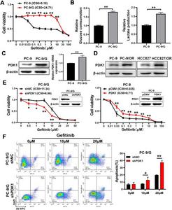 Glycolysis gatekeeper PDK1 was an essential regulator of gefitinib resistance in lung cancer.