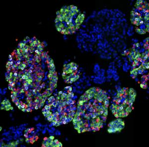 Immunofluorescence image of the pancreatic islets of a 50-year-old-female without diabetes