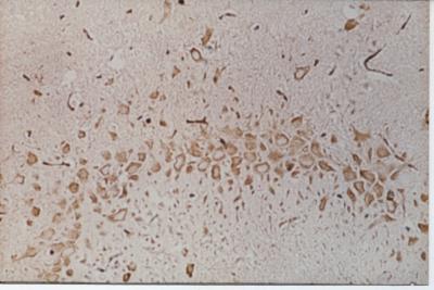 Pretreatment Group