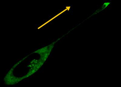 Invasive Tumor Cell