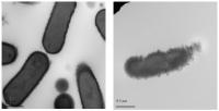 Listeria (before and after)