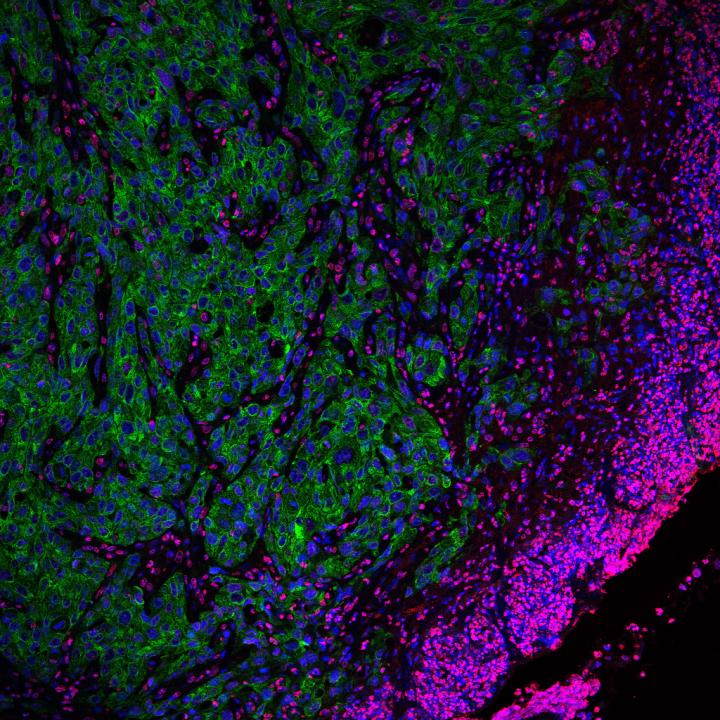 Confocal microscopy image