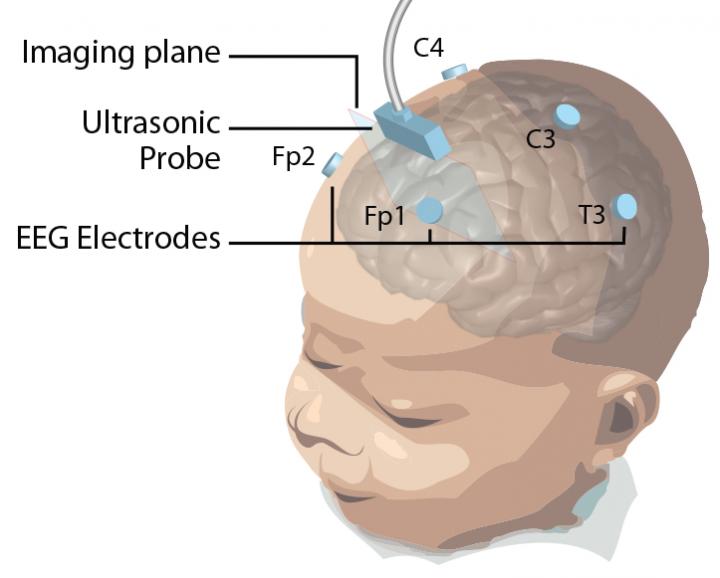 A Portable Bedside Brain Scanner for Babies (1 of 6)