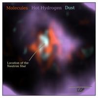 The SN1987A System