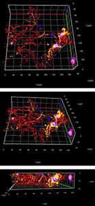 Motor neurons